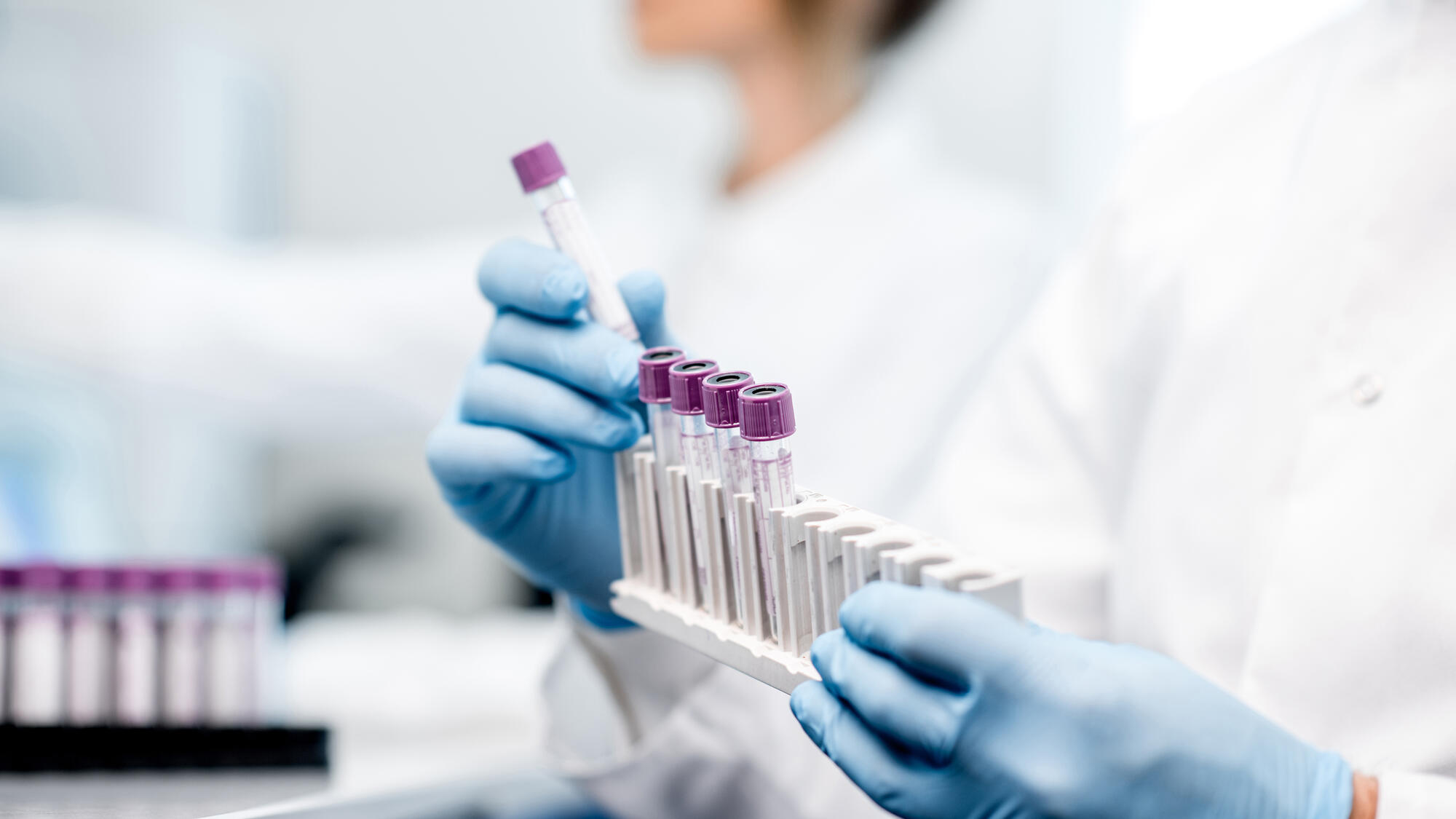 White coat technicians working with tubes in the lab